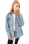 Sky Blue Acid Wash Flap Pocket Boyfriend Shacket-Outerwear-MomFashion